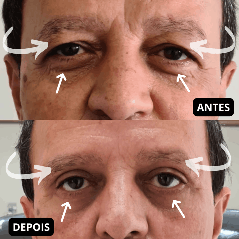 Clinica Cirurgião Médico Lifting Facial São Paulo SP